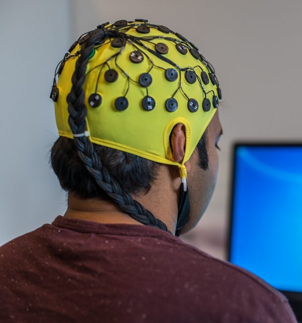 electroencephalography